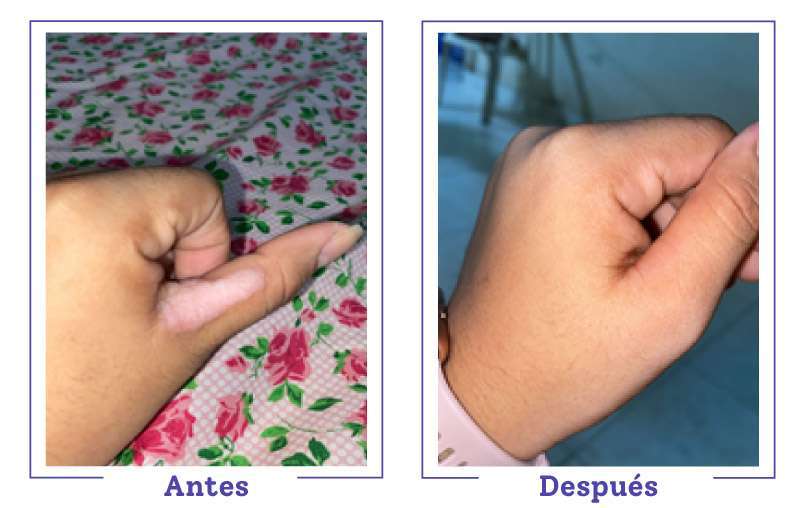 antesy-despues4